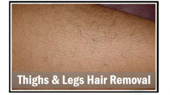 thighs-&-legs-hair-removal