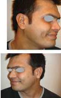 After treatment